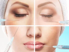 Что такое филеры для лица и зачем они нужны